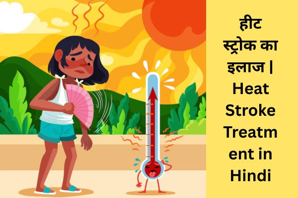 हीट स्ट्रोक क्या है? | Heat Stroke Meaning in Hindi