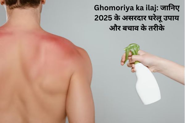 Ghomoriya ka ilaj: जानिए 2025 के असरदार घरेलू उपाय और बचाव के तरीके